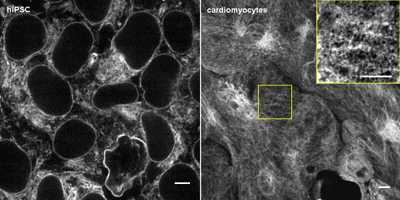 Cell line media